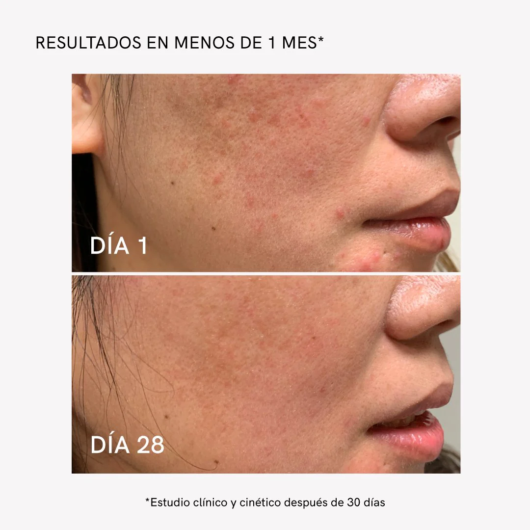 Serum Triphasic 100ml - Image 4
